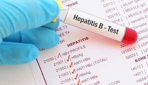 Hepatitis B